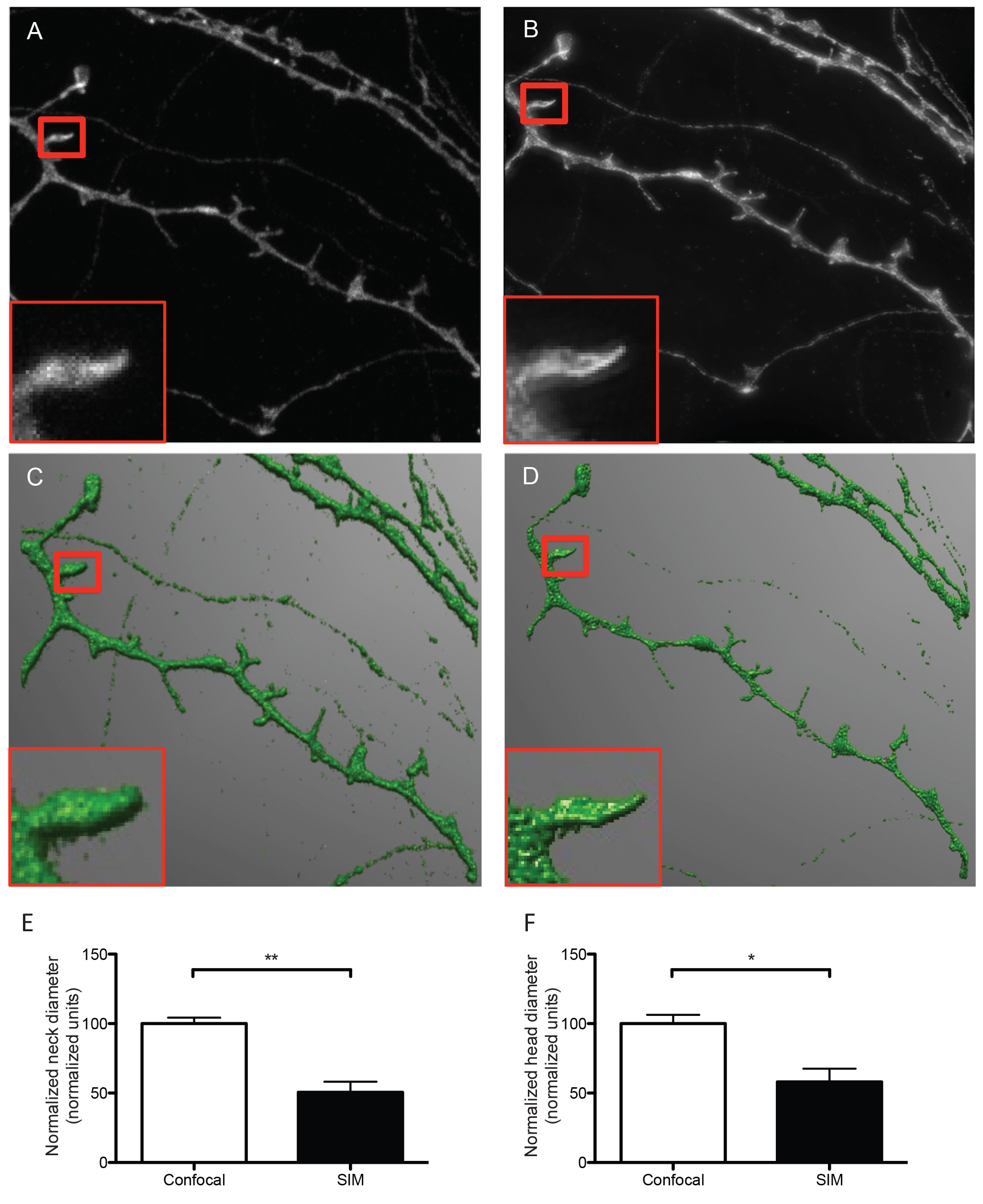 Video: Imaging Dendritic Spines of Rat Primary Hippocampal Neurons ...