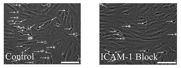 figure-results-5 Cell adhesion comparison, microscopy image; control vs. ICAM-1 block, arrow indicators.