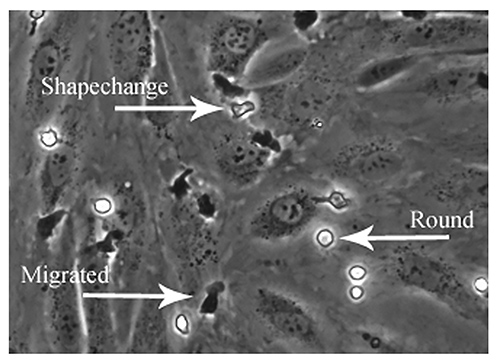 figure-results-6 Cell migration and morphology change, microscope image, cellular shape analysis, experimental study.