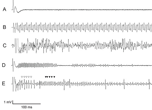 figure-results-2 Neuronal activity graph; electrophysiology traces, measuring electrical potentials over time.