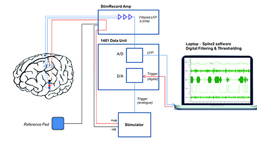 Neuroscience experiment diagram; EEG recording, data unit, digital filtering, signal analysis.