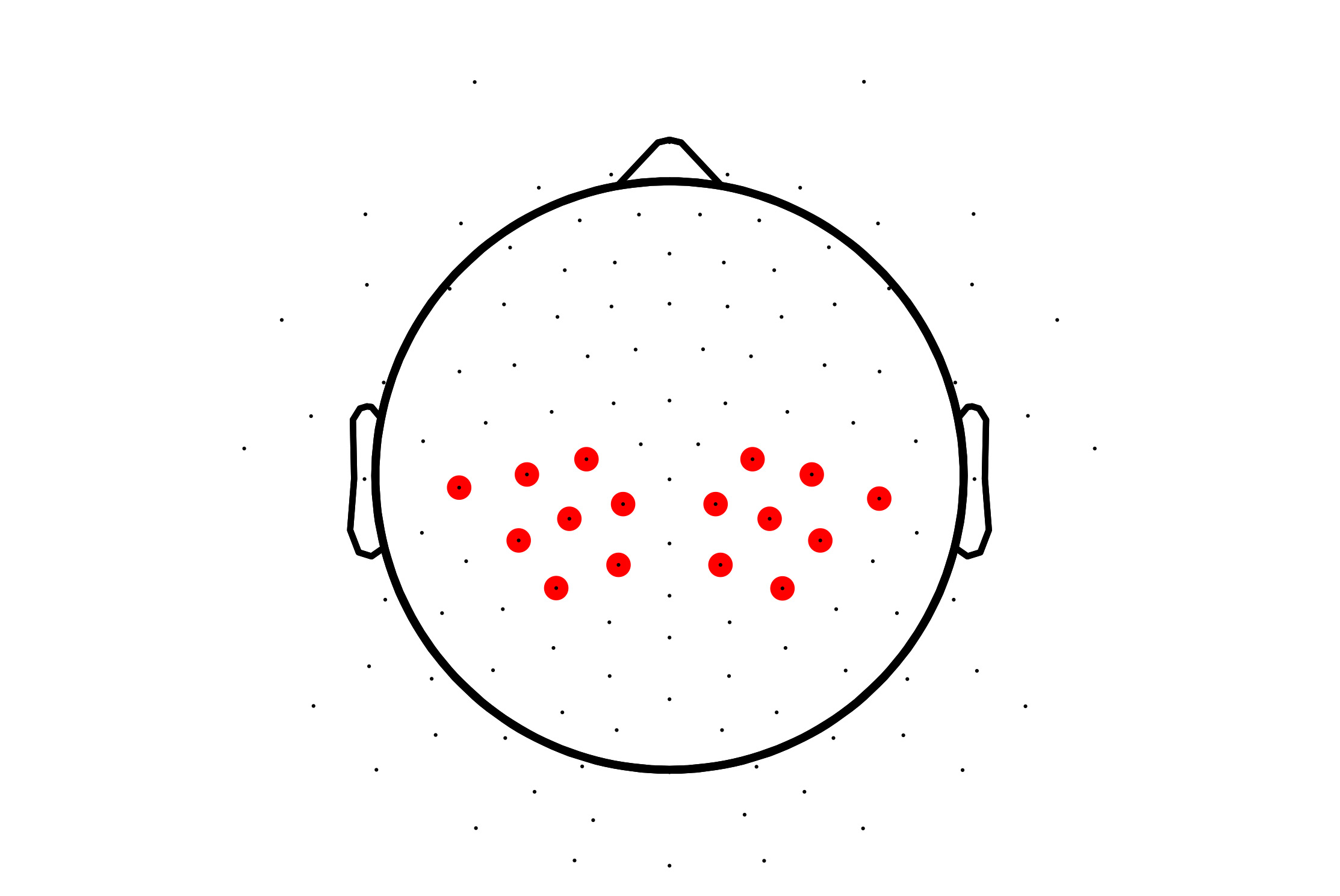 EEG Mu Ritmo no desenvolvimento típico e atípico