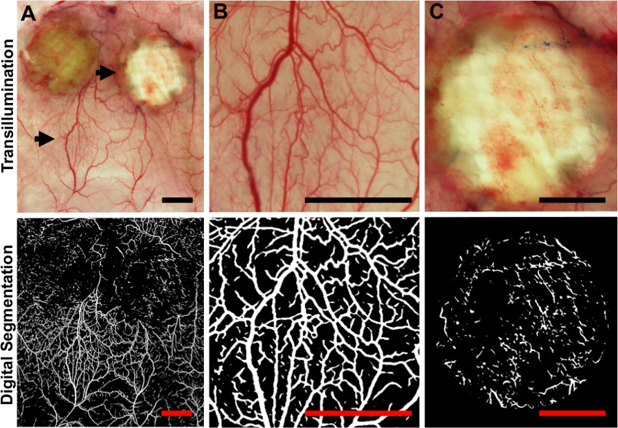 Transillumination and digital segmentation of blood vessels; diagram of vascular mapping results.