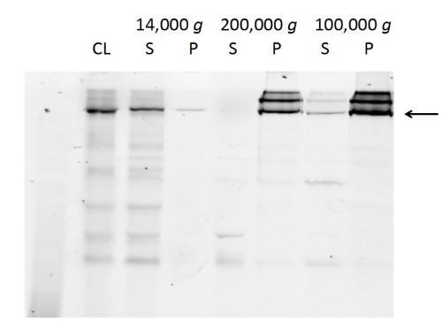 figure-results-1 Electrophoresis gel showing protein separation at various centrifugation speeds; arrow indicates band.