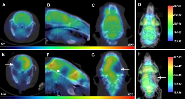 PET scan analysis diagram highlighting metabolic activity variations, with color intensity scale.