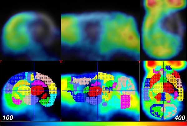 PET scan imaging, brain activity analysis, topographical representation, quantitative assessment.