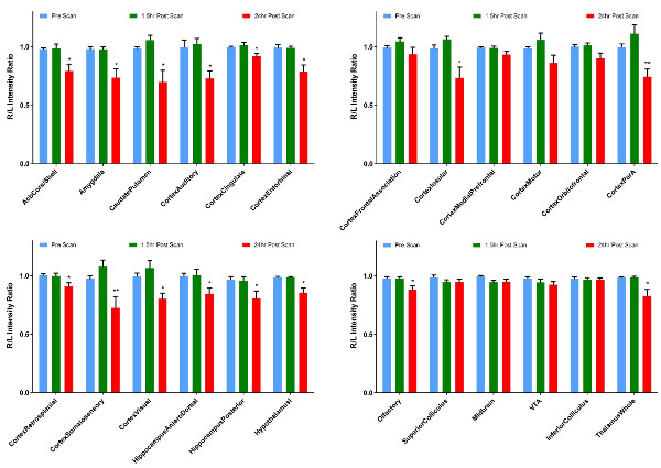 Bar charts of luminescence ratios at different brain regions pre- and post-scan in an experiment.
