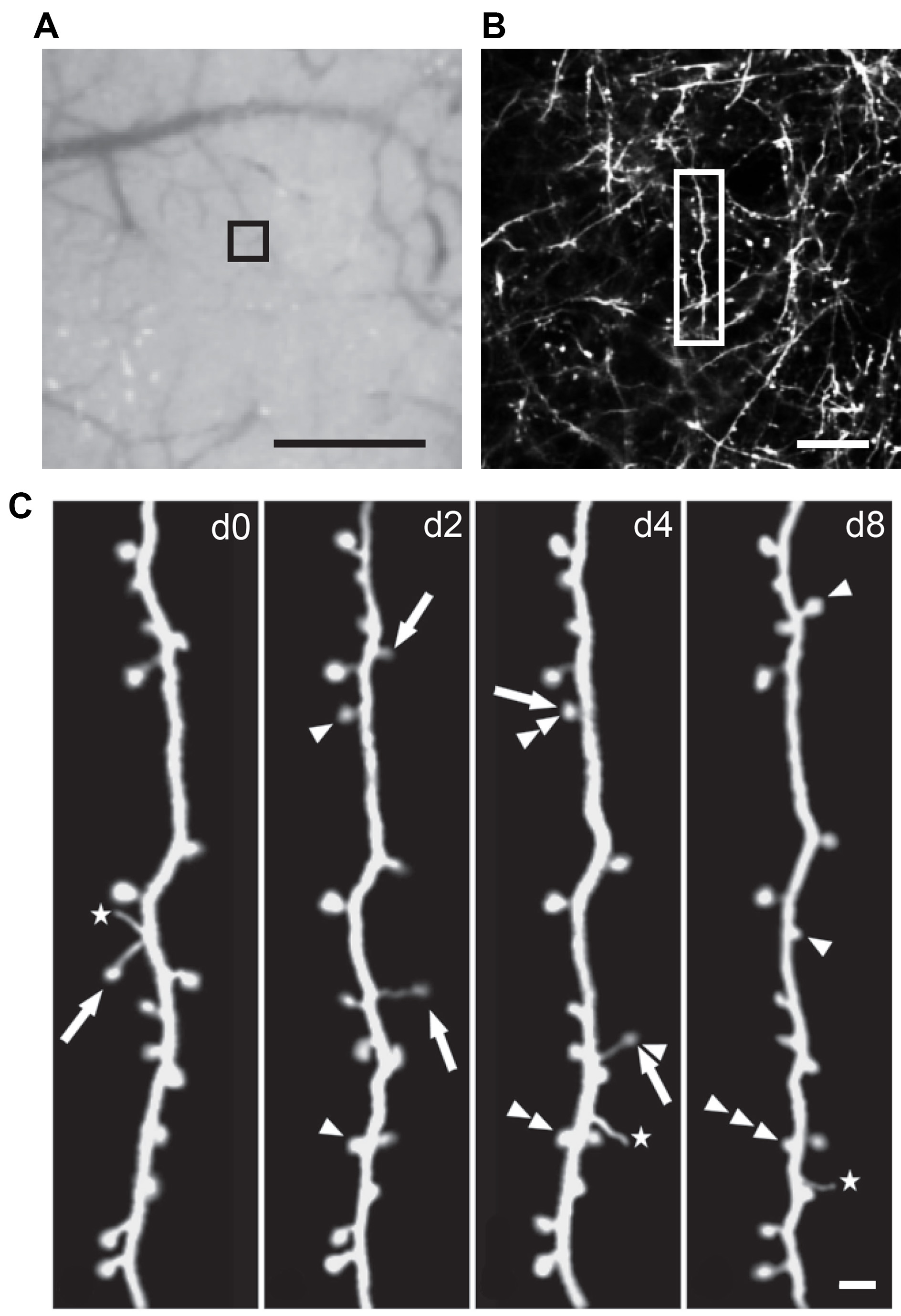 Neuronal dendritic spine development, microscopy analysis, neuron structure visualization, time-lapse.