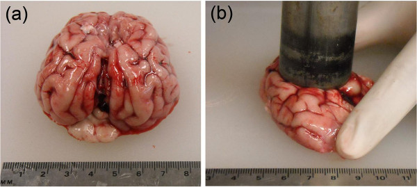 figure-results-2 大脑机械压缩过程;正常状态与压缩状态的比较研究;实验。