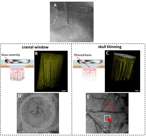 Cranial imaging techniques comparison; diagrams, microscopy, skull thinning vs. cranial window setup.