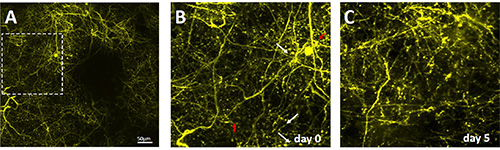 Neural network growth over 5 days, fluorescence microscopy, imaging neuron connections, growth analysis.