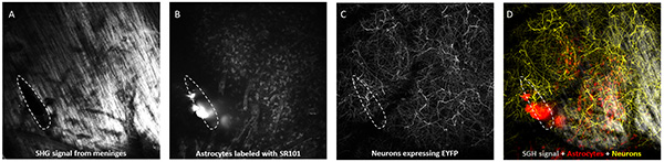 Second harmonic generation microscopy; SHG signal, astrocyte labeling, neuron expression; imaging results.