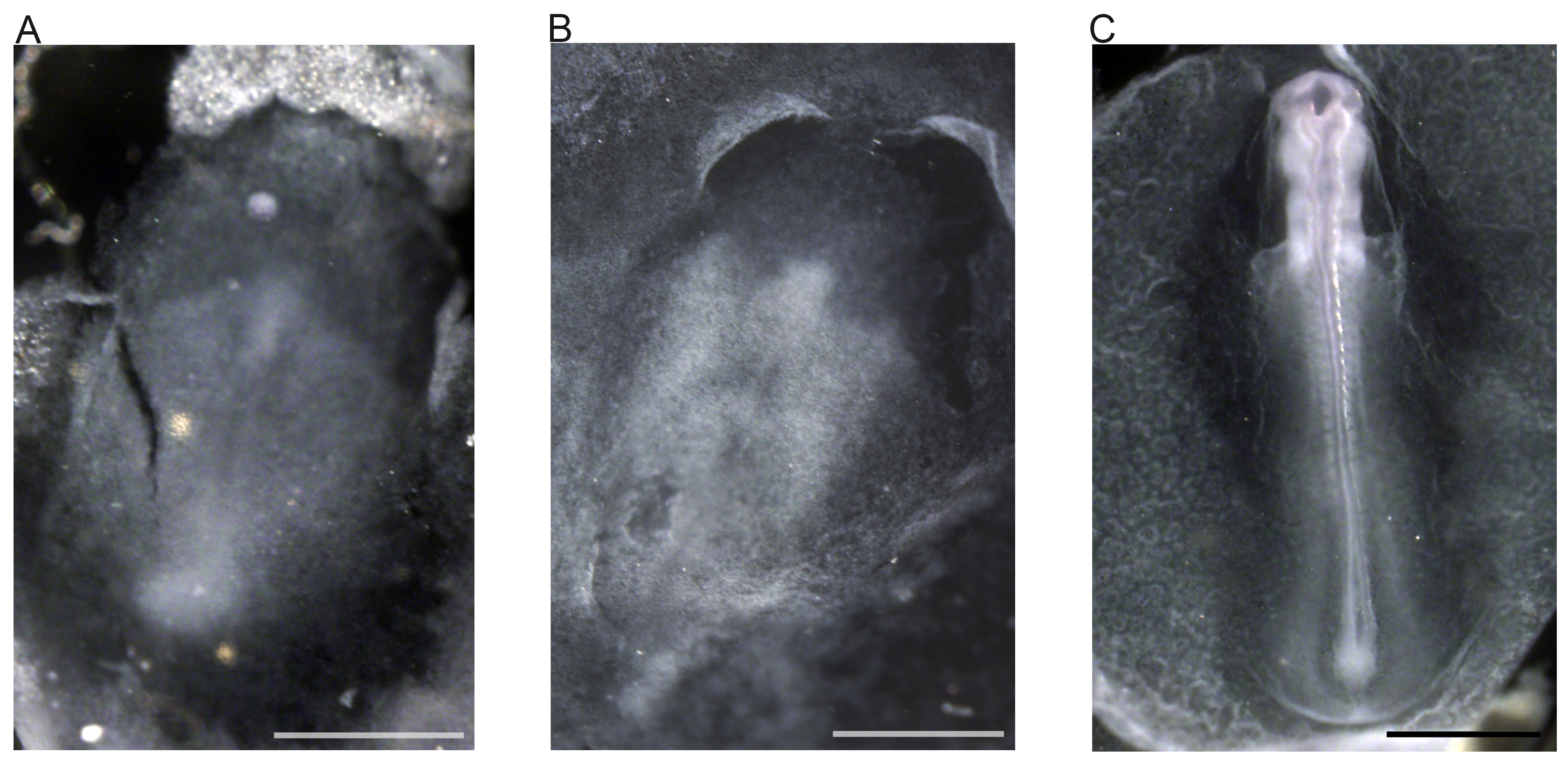 Embryonic development stages, microscope images, showcasing growth progression, cellular differentiation.