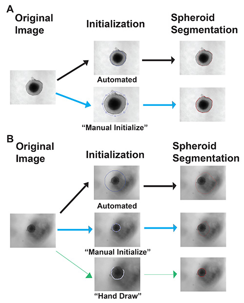 figure-results-4 Spheroid segmentation process diagram with automated, manual, and hand-drawn initialization methods.