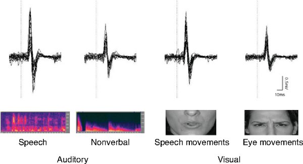 figure-results-2 Auditory-visual integration in speech; waveforms, spectrogram, facial movements; diagram analysis.