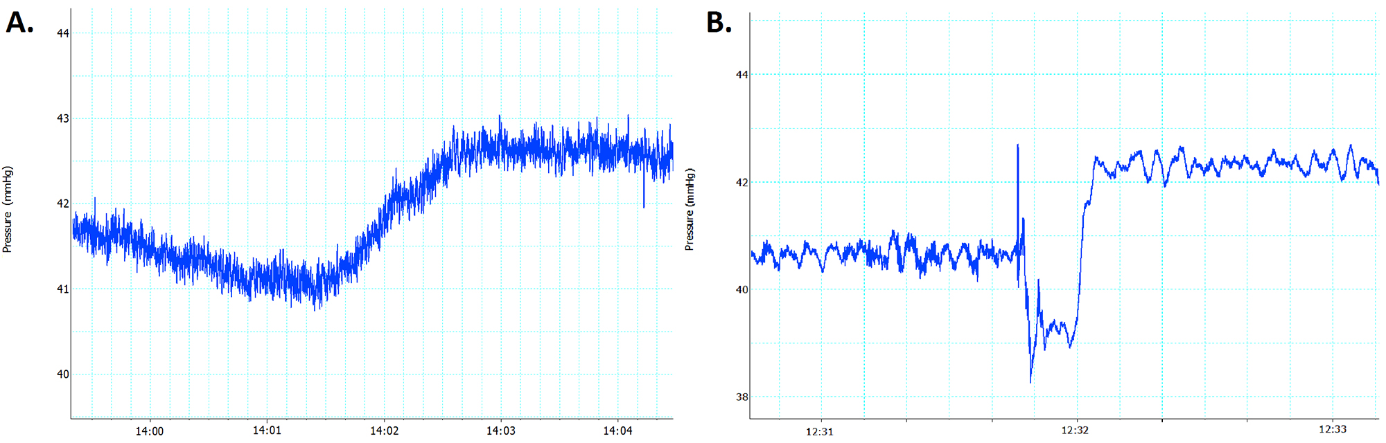 Blood pressure fluctuation graphs; chart comparison of changes over time in mmHg during experiment.