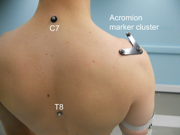 figure-protocol-1 Badanie biomechaniczne; klaster markerów akromionu na plecach; używany do analizy ruchu; rozmieszczenie markerów.