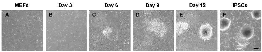 Cell differentiation process; microscopy images; MEFs to iPSCs over days 3, 6, 9, 12; stem cell study.