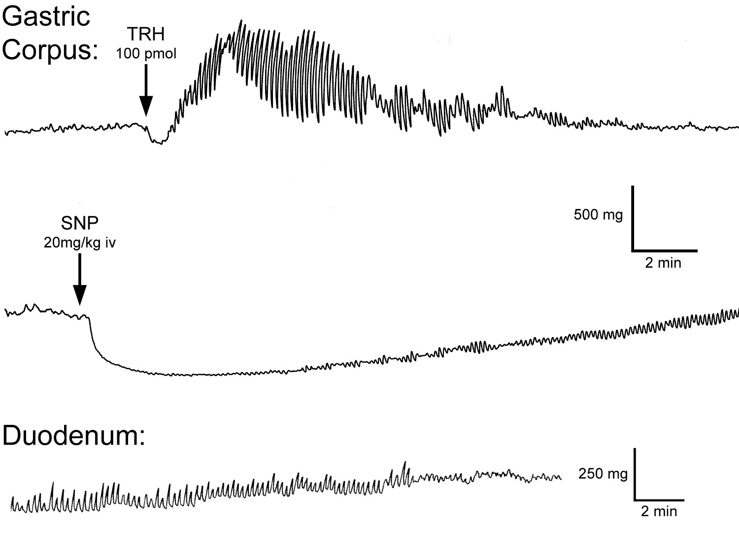 Gastric motility graph; TRH and SNP impact on gastric corpus and duodenum contraction; experiment.