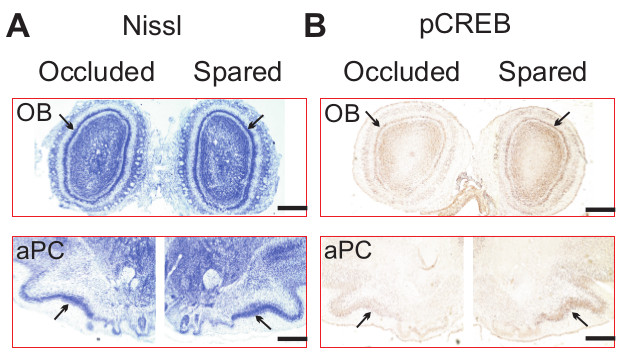 A Lateralized Odor Learning Model in Neonatal Rats for Dissecting ...