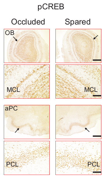 pCREB expression comparison, occluded vs. spared states, in brain tissue sections, diagram analysis.