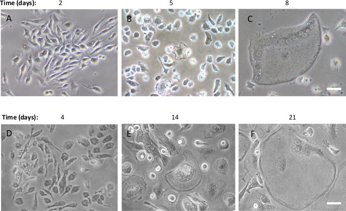 Cell growth over 21 days; microscope images at days 2, 4, 5, 8, 14, 21; cellular morphology change.