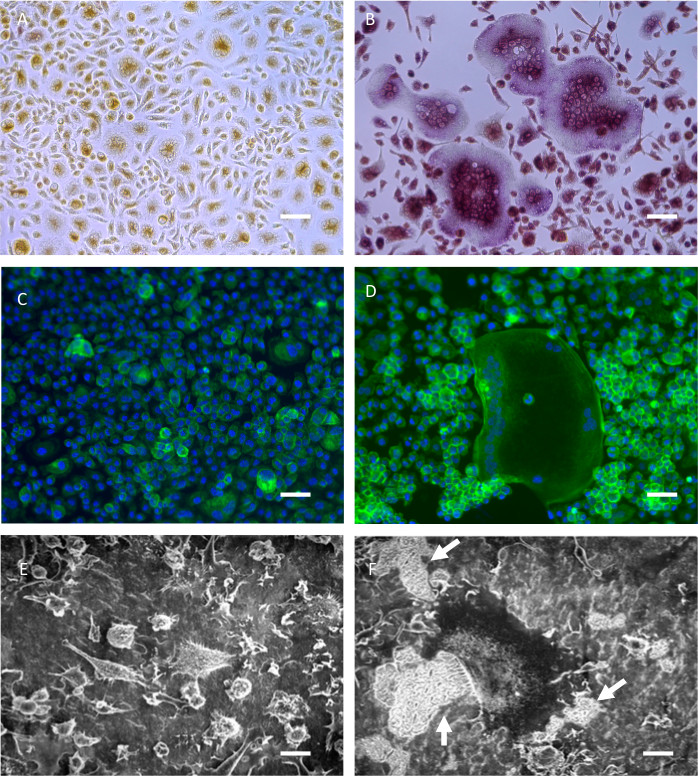 Cell morphology study with microscopy. Top row: live cell imaging, bottom: high magnification detail.