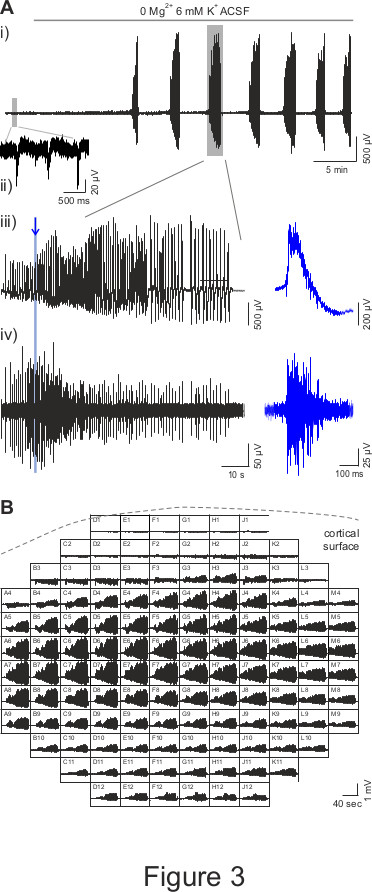 figure-results-3 Electrophysiological waveforms, cortical surface recordings, 0 Mg2+ 6 mM K+ ACSF, voltage analysis diagram.