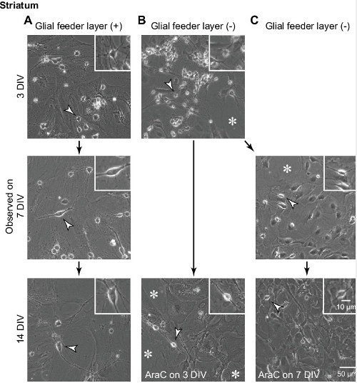 Striatum cell culture diagram, glial feeder layer effect, DIV comparison, microscopy analysis.