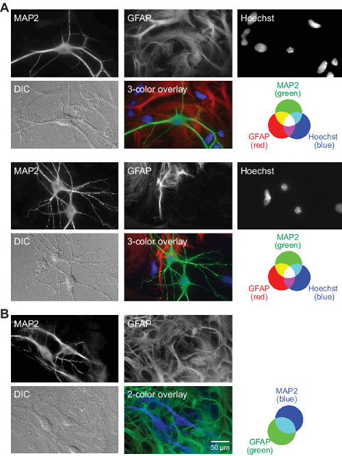 Immunofluorescence microscopy with MAP2, GFAP, Hoechst stain; cell structure identification diagram.