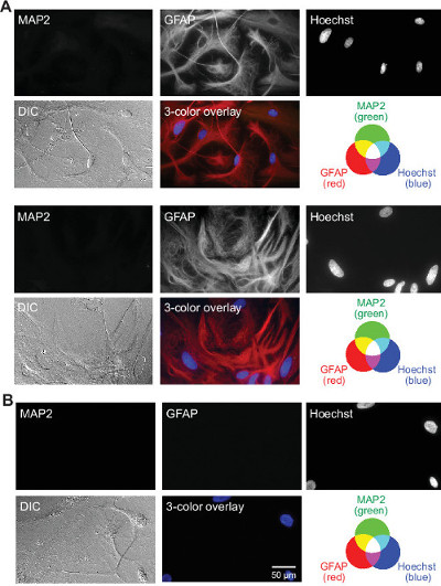 Immunofluorescence microscopy diagram of MAP2, GFAP protein, Hoechst dye, 3-color overlay results.