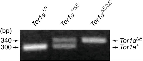 Gel electrophoresis result; DNA bands showing Tor1a genotypes at 300-340 bp.