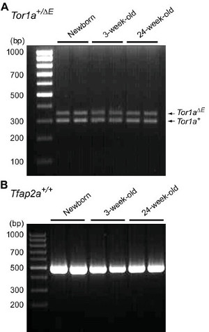 Gel electrophoresis results, Tor1a and Tfap2a expression analysis, DNA band separation by age.