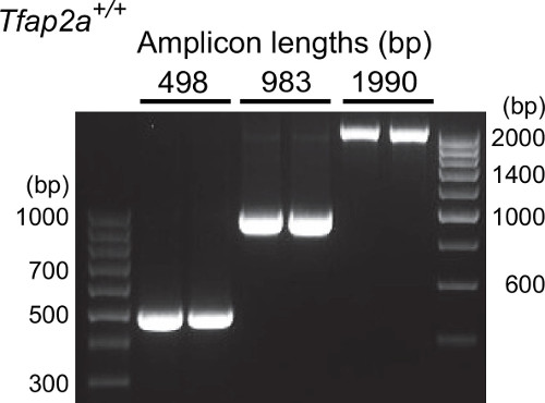 Gel electrophoresis results; DNA amplicon lengths 498, 983, 1990 bp; molecular marker ladder.