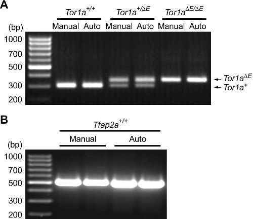 Electrophoresis results; DNA separation on gel chart; bands for Tor1a and Tfap2a experiments.