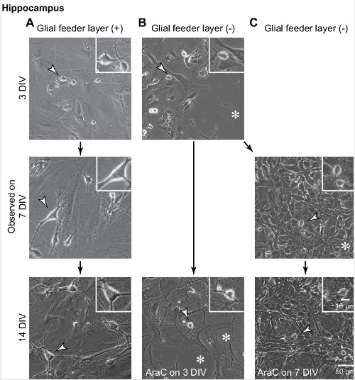 Hippocampal neuron culture process; glial feeder layer effects; microscopy images; 3, 7, 14 DIV; analysis.
