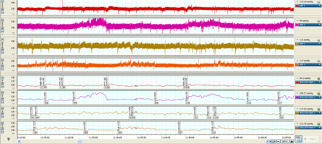 Physiological signal analysis, multi-channel graph, data monitoring, biomedical research.