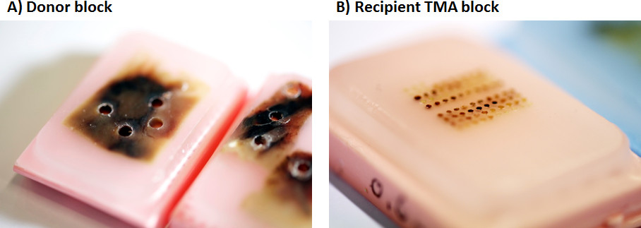 figure-results-1 Donor and recipient TMA blocks for tissue microarray setup; histological analysis preparation.