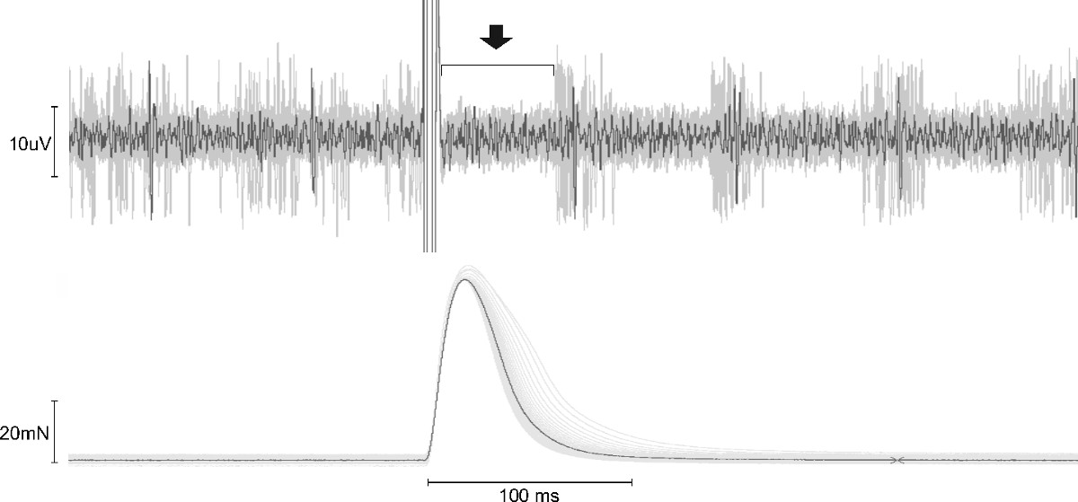 figure-results-2 Neural signal graph with electromyography data and muscle force response; experiment result.