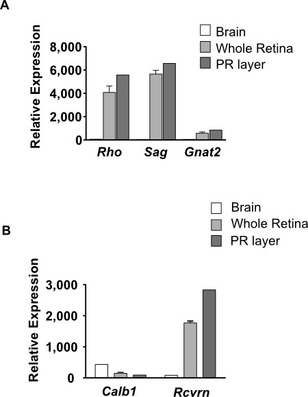 Gene expression analysis; bar chart; Rho, Sag, Gnat2, Calb1, Rcvrn; retina, brain comparison.