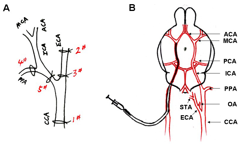 Embolic Middle Cerebral Artery Occlusion (MCAO) for Ischemic Stroke ...