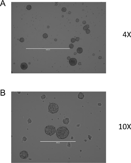 figure-results-1 Microscope image of cell aggregation at 4X and 10X magnification, highlighting cell growth.