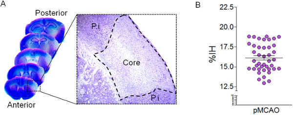 figure-results-2 Brain section analysis; histology micrograph and data graph of ischemic area percentage comparison.