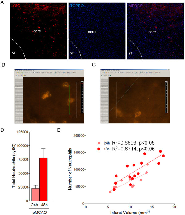 figure-results-3 Fluorescence microscopy, Ly6G staining, neutrophil count, infarct volume correlation, bar, and scatter graphs.