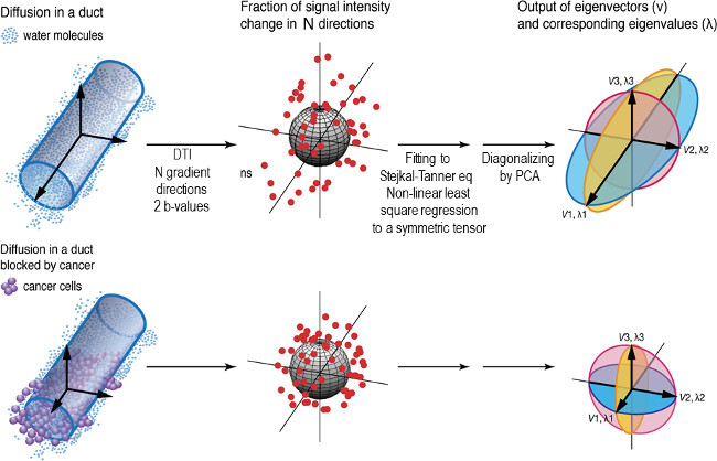 Diffusion MRI diagram; water molecule vs. cancer cell diffusion; PCA eigenvector analysis process.