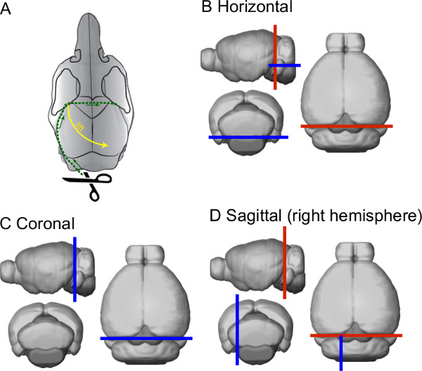 Slice It Hot: Acute Adult Brain Slicing in Physiological Temperature