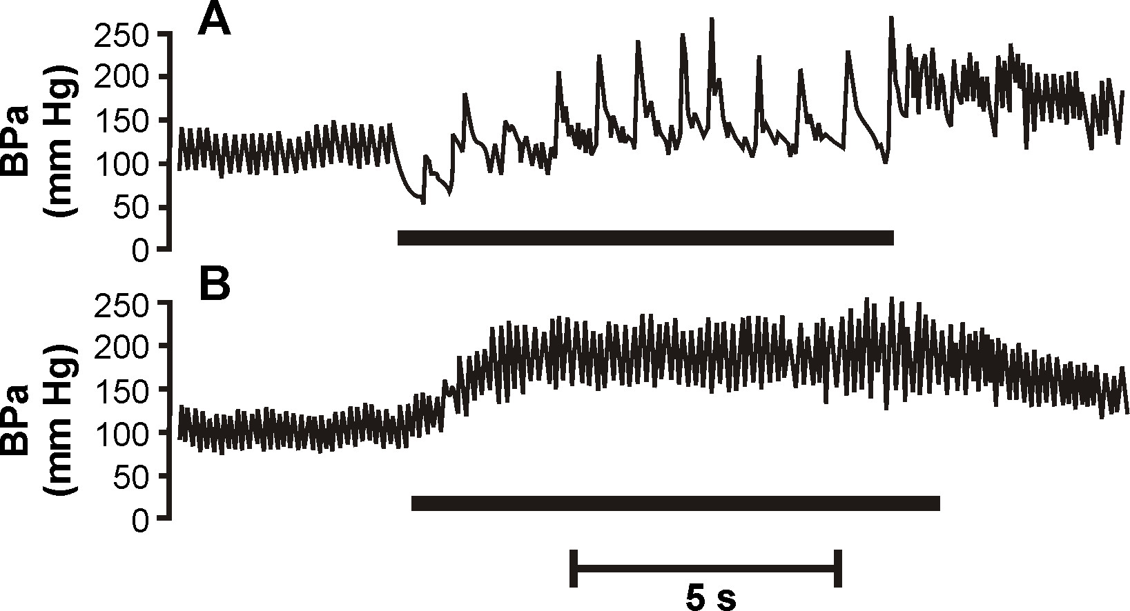 Blood pressure waveform analysis in a graph showing arterial readings over 5 seconds; BPa (mm Hg).
