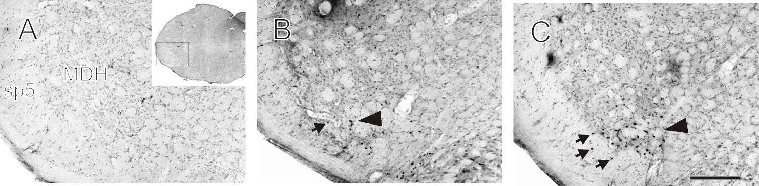 Histological sections showing neuronal structure; labeled arrows indicate key regions and cells.