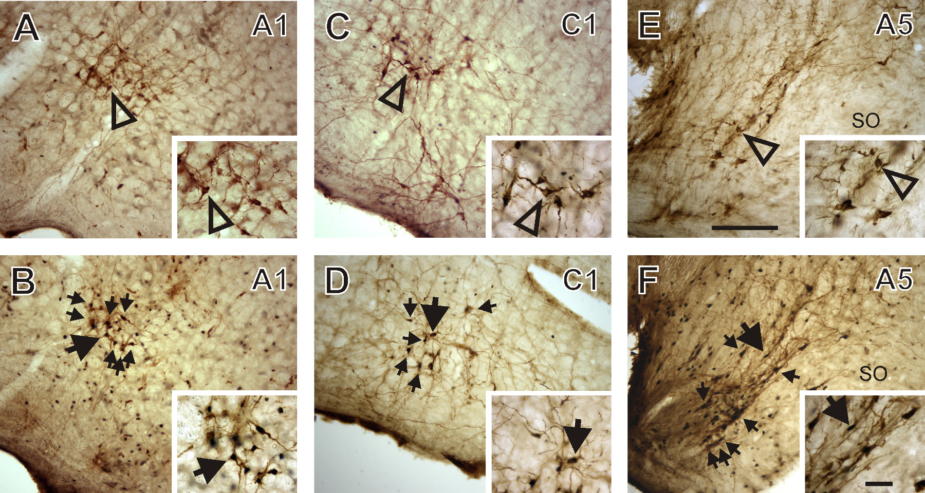 Neuronal structure analysis using microscope images, highlighting nerve cell morphology, research.