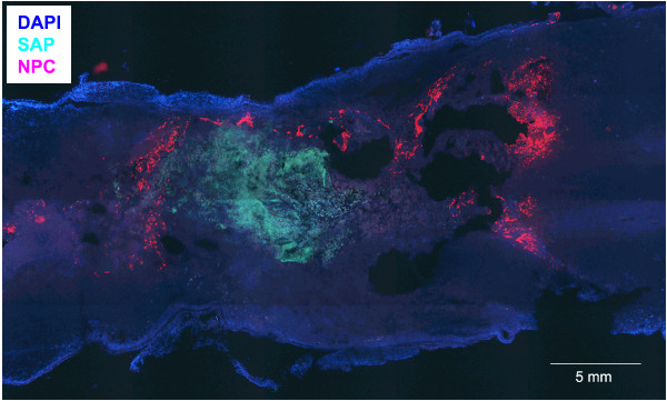 Synergetic Use of Neural Precursor Cells and Self-assembling Peptides ...